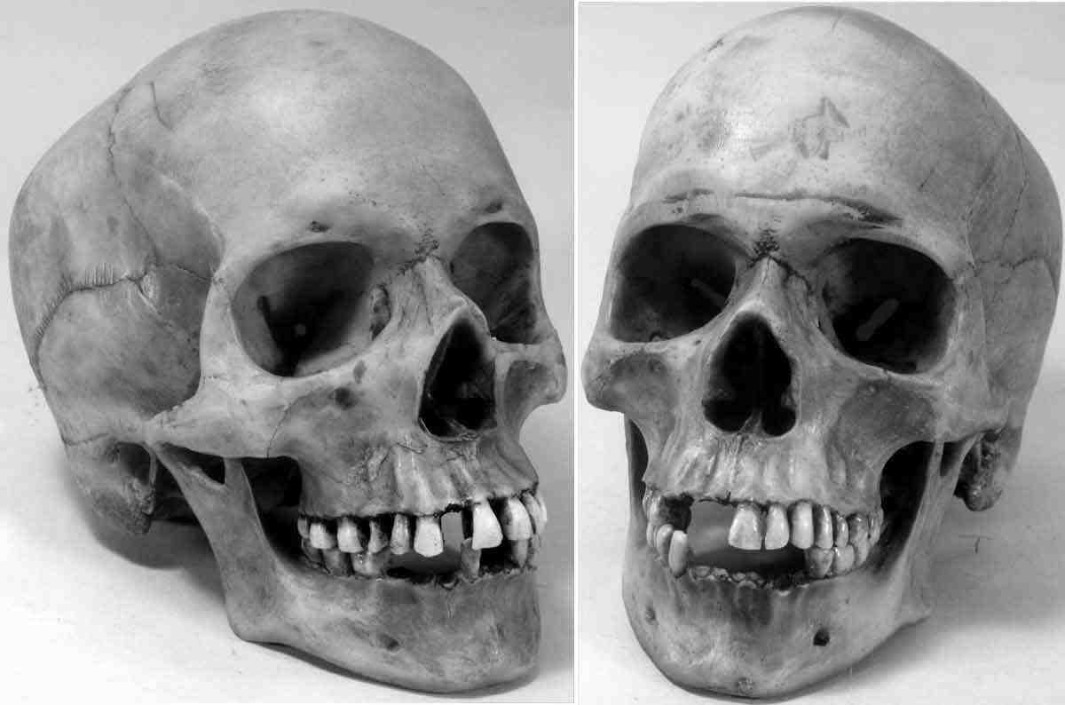 #3093: Authentic Human Skull-Life Size Replica Aged Relic, Crypt Dust Gray, Medical Anatomy Reproduction; #3093-3020 USA - FREE SHIPPING!